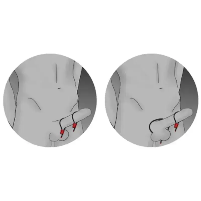 Cavetti elettrostimolanti per pene e/o testicoli ELECTRASTIM